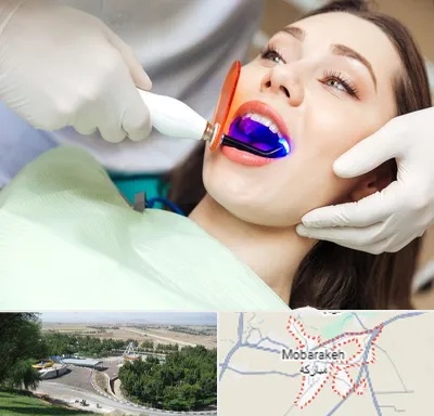 دندانپزشکی بدون درد در مبارکه