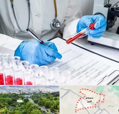 آزمایشگاه اعتیاد در البرز