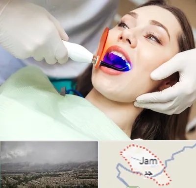 دندانپزشکی بدون درد در جم