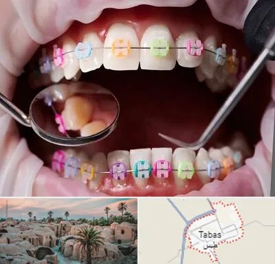 متخصص ارتودنسی در طبس