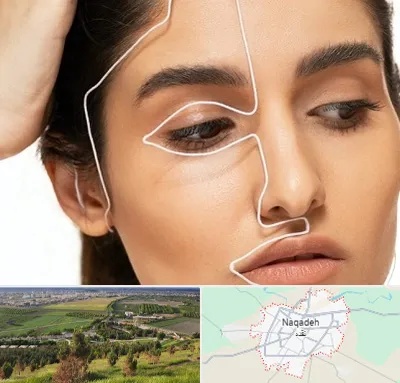 عمل بینی اقساطی در نقده