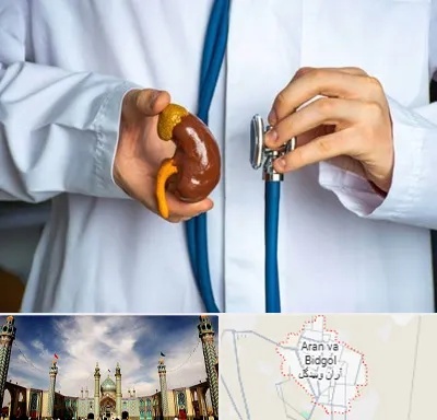 دکتر سرطان کلیه در آران و بیدگل