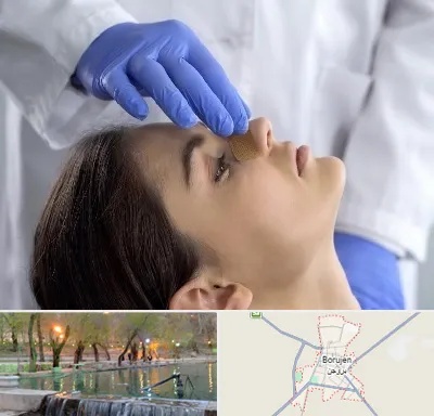 عمل بینی عروسکی در بروجن