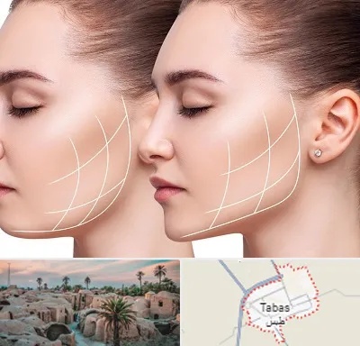 جراحی بوکال فت در طبس