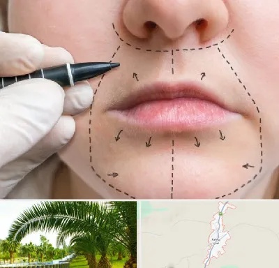 عمل سانترال لب در کهنوج