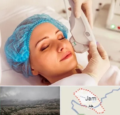 اکسنت در جم