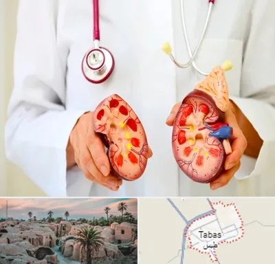 دکتر سنگ کلیه در طبس