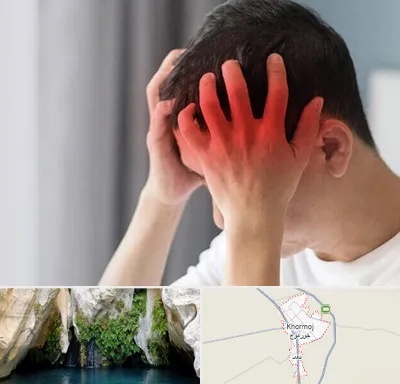 دکتر میگرن در خورموج