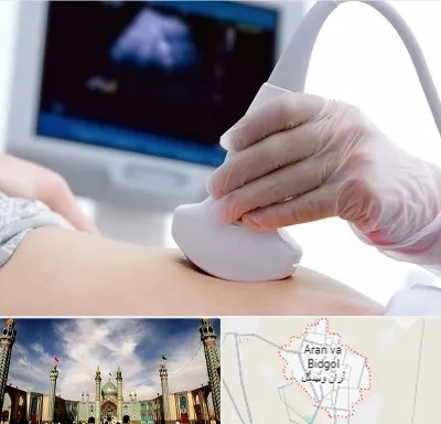 سونوگرافی در آران و بیدگل
