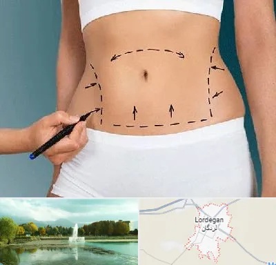 دکتر طب سنتی برای لاغری در لردگان