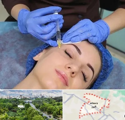 تزریق پروفایلو در البرز