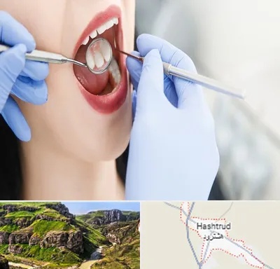 جراح دندان عقل در هشترود