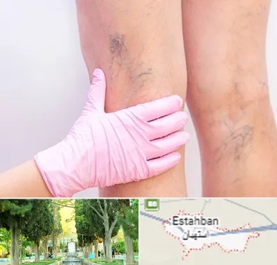 دکتر فوق تخصص واریس در استهبان