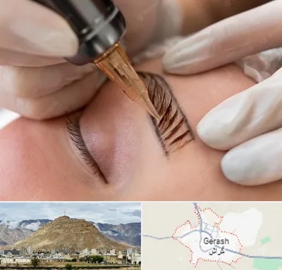 میکروبلیدینگ در گراش