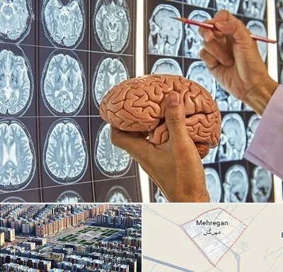 دکتر فوق تخصص جراح مغز و اعصاب در مهرگان