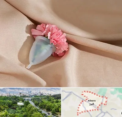 جراح سرطان واژن در البرز