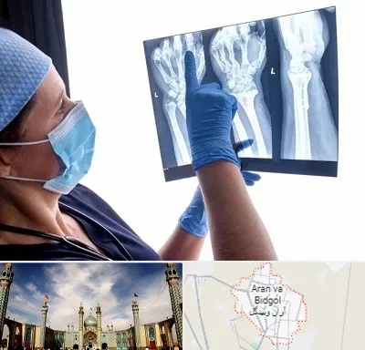 تجهیزات ارتوپدی در آران و بیدگل