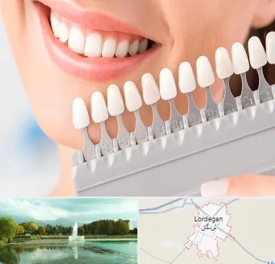 متخصص لمینت دندان در لردگان