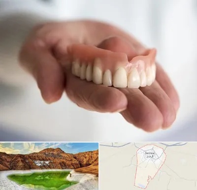 لیفت لثه با لیزر در گرمسار
