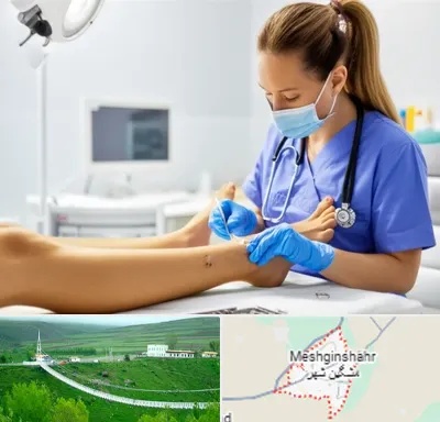 کارشناس زخم در مشگین شهر