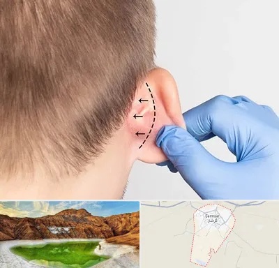 عمل زیبایی گوش در گرمسار