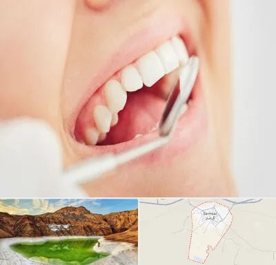 اصلاح طرح لبخند در گرمسار