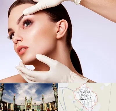 دکتر رفع غبغب در آران و بیدگل