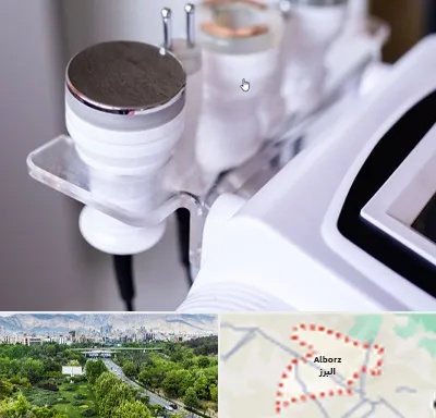 مرکز لاغری با کویتیشن در البرز