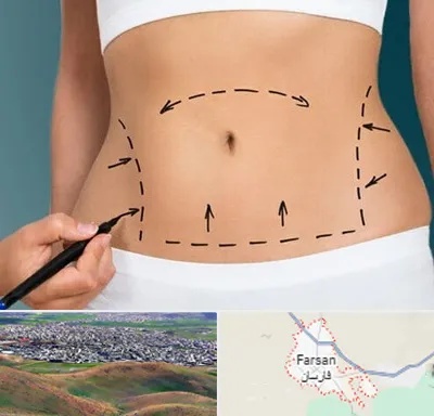 عمل ابدومینوپلاستی در فارسان