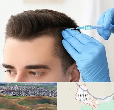 مزوتراپی مو در فارسان
