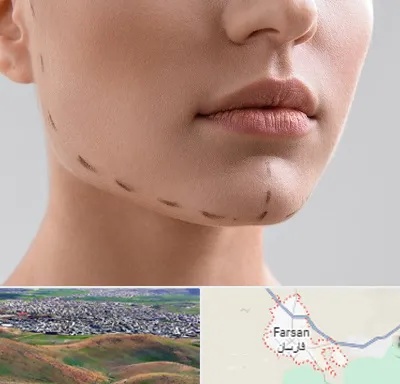 عمل زاویه فک در فارسان
