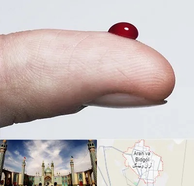 مرکز فصد خون در آران و بیدگل