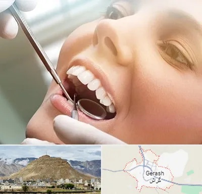 دندانپزشکی زیبایی در گراش