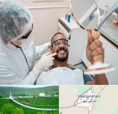 ایمپلنت فوری در مشگین شهر