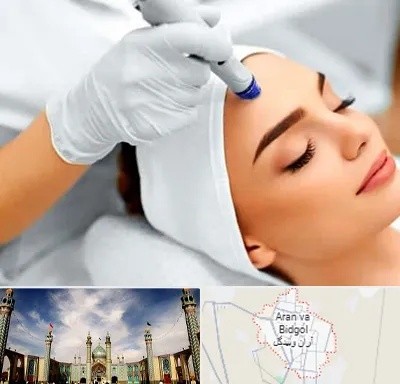 آموزش مزوتراپی در آران و بیدگل