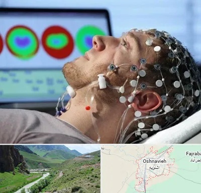 مرکز نوار مغز در اشنویه