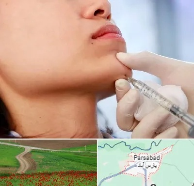 زاویه سازی صورت در پارس آباد