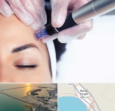 کلینیک مزوتراپی صورت در بندر کنگان