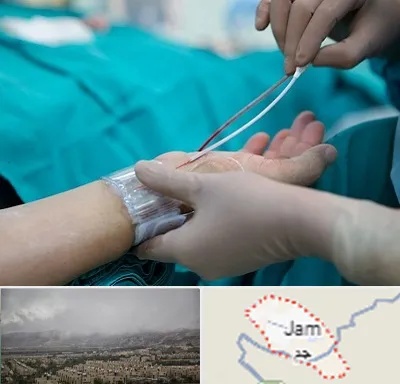 آنژیوگرافی در جم