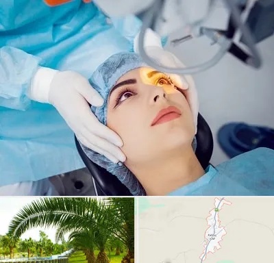 دکتر عمل لیزیک چشم در کهنوج