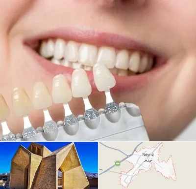 مرکز کامپوزیت دندان در نی ریز