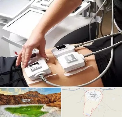 ترواسکالپ در گرمسار