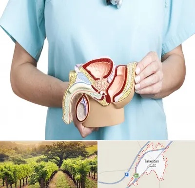 فوق تخصص دستگاه تناسلی مردان در تاکستان