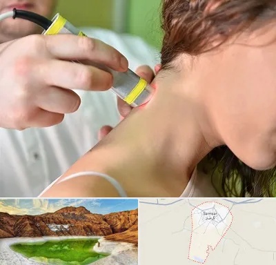 لیزر درمانی در گرمسار