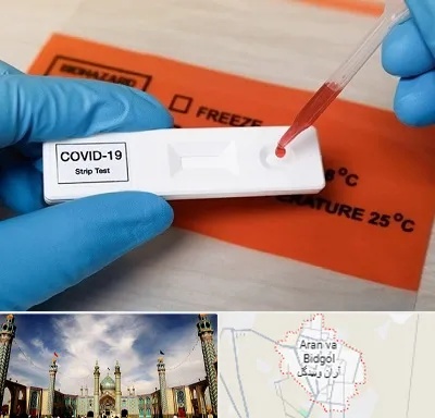 آزمایشگاه کرونا در آران و بیدگل