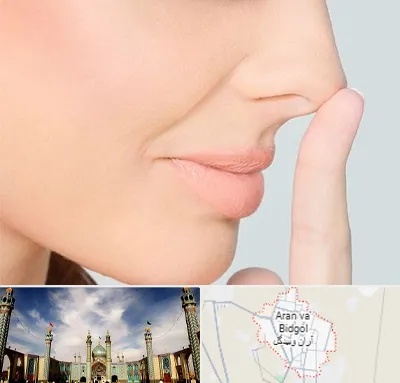 عمل تیپ پلاستی بینی در آران و بیدگل