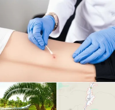 متخصص زخم بستر در کهنوج