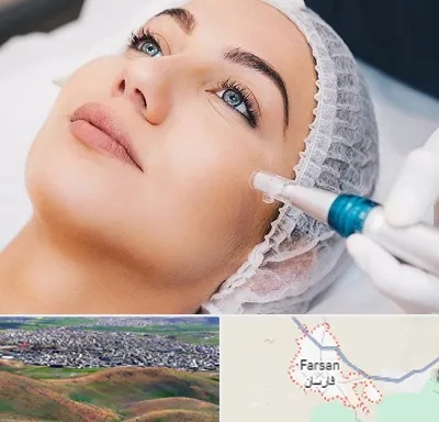مزونیدلینگ در فارسان