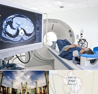 مرکز تصویر برداری پزشکی در آران و بیدگل