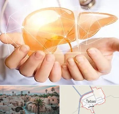 دکتر سرطان کبد در طبس